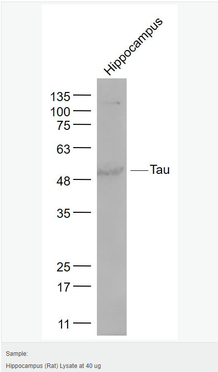 6052ad866b315.png image.png