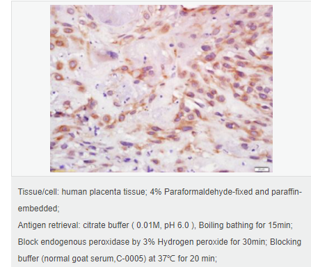 606147e88677f.png image.png